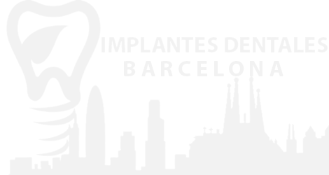 Implantes Dentales Barcelona